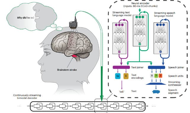 Sabicap Develops Brain Wearable to Decode Imagined Speech into Text
