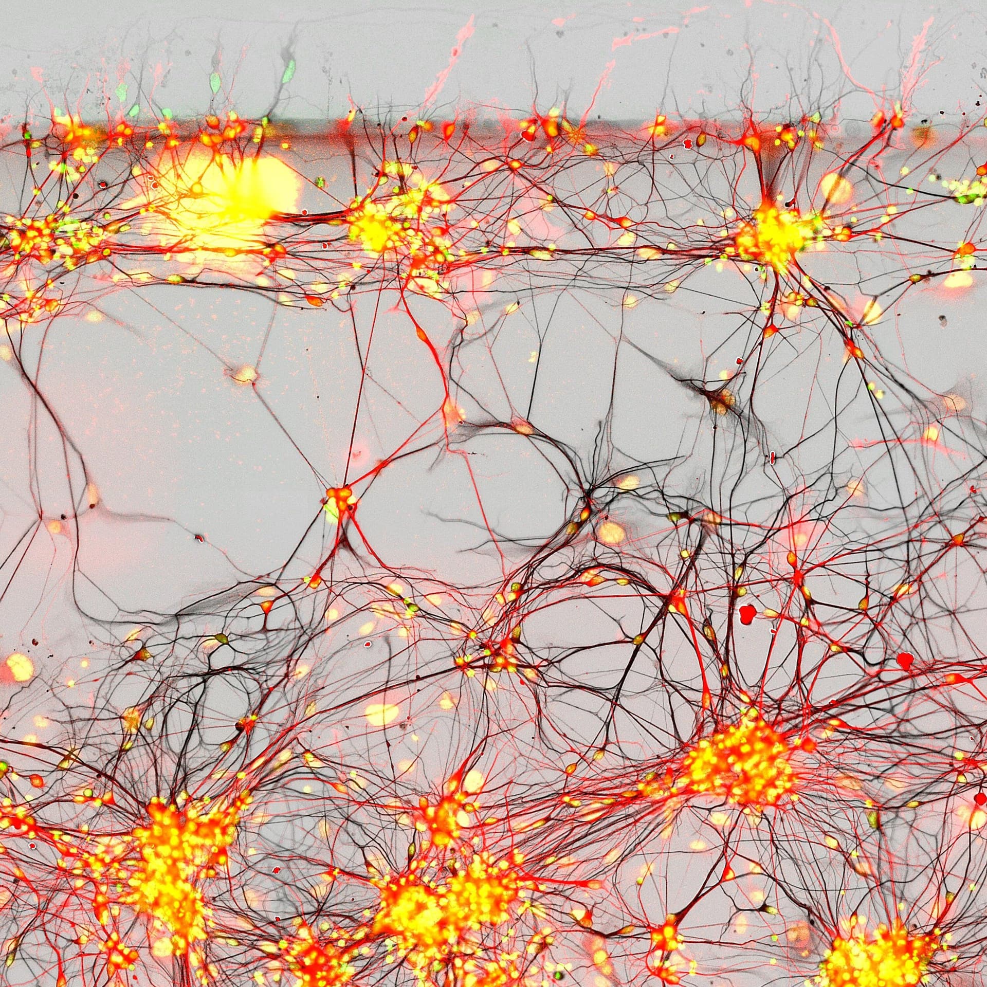 Lab-cultured neurons extending thread-like dendrites across a dish, forming new synaptic connections in a time-lapse…