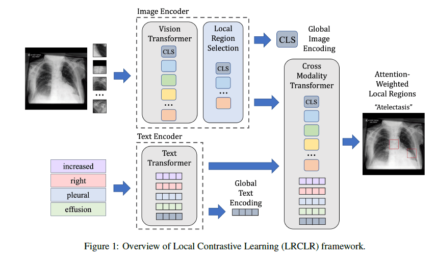 Medical scan images overlaid with grid deformation patterns, illustrating the CoRe framework's alignment process for…