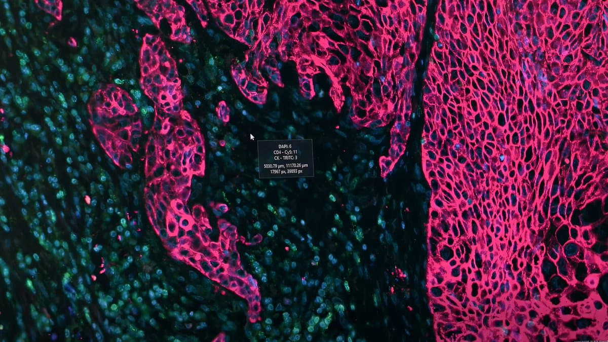 Microsoft's AI Converts Standard Pathology Slides to Spatial Proteomics Maps, Cutting Costs and Time