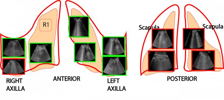 Lung-R1-14B Tops EMR Diagnosis with Knowledge Graph-Guided RL